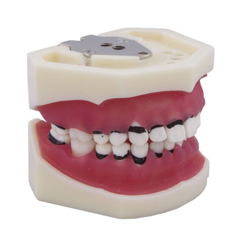 Molde silicona para modelo desdentado BADER®️ DENTAL - Bader®️ Dental